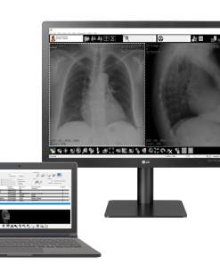 Console de diagnostic Radiologie