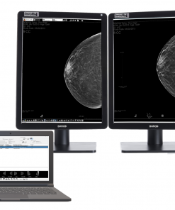 Console de diagnostic Mammographie